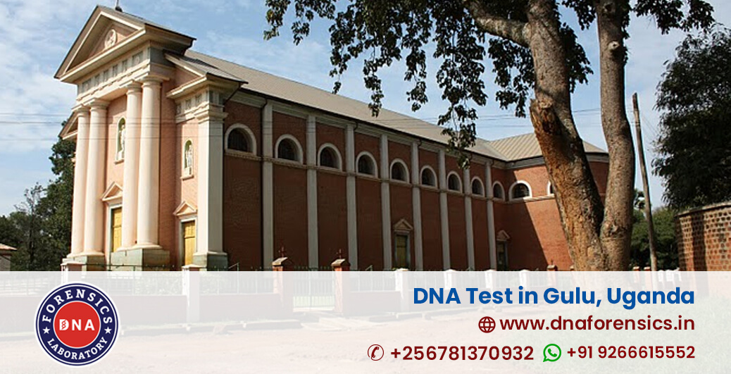 DNA Test in Gulu