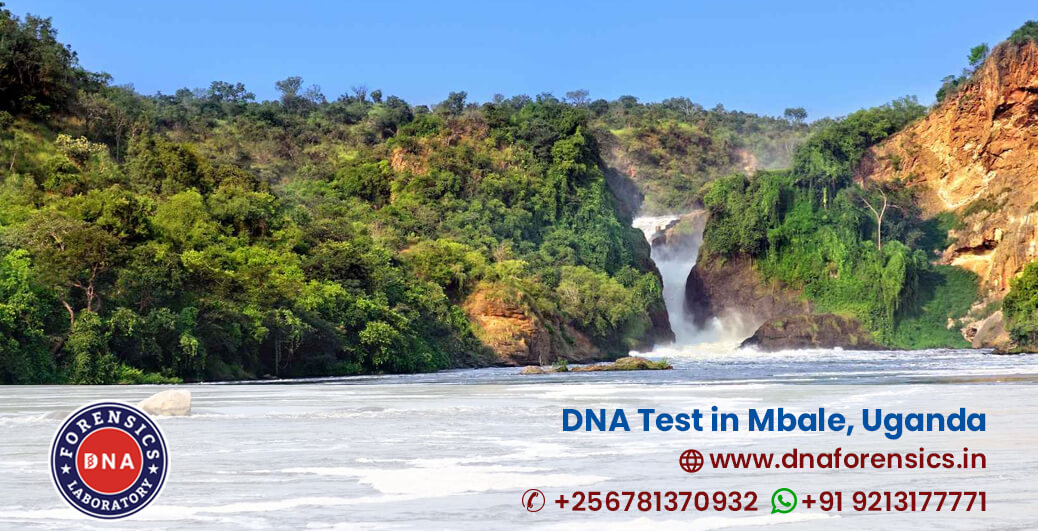 DNA Test in Mbale