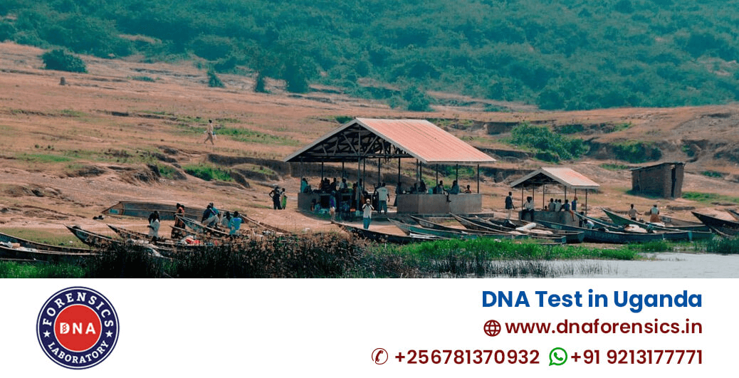 DNA Test in Uganda