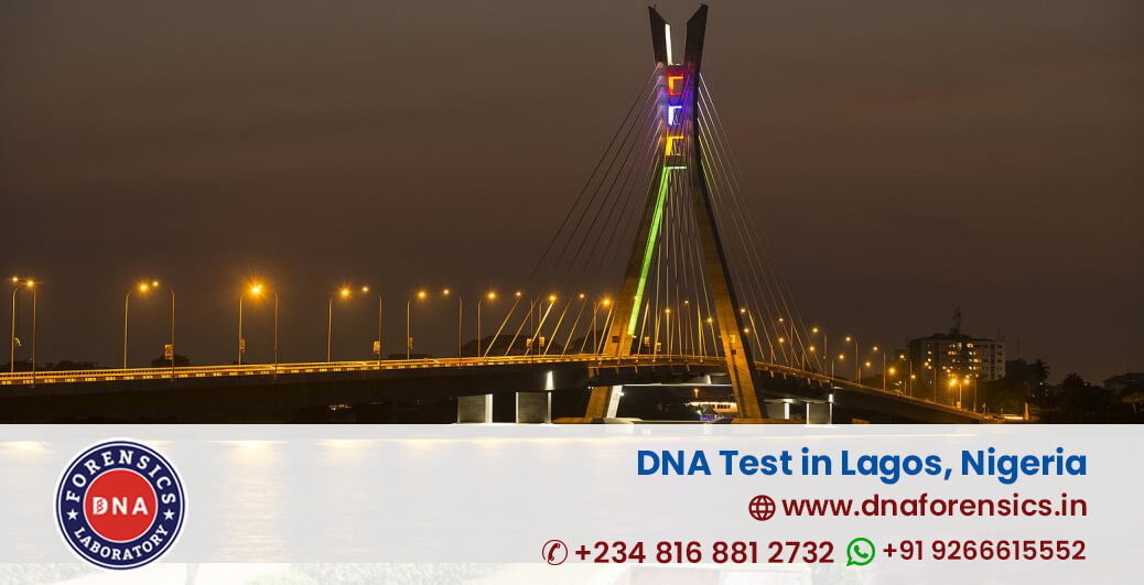 DNA Test in Lagos