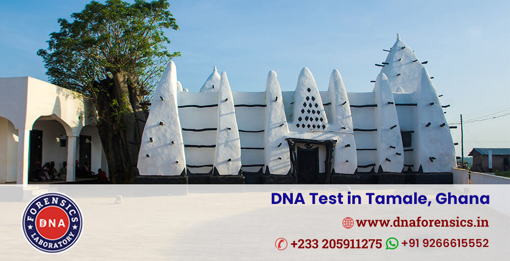 DNA Test in Tamale
